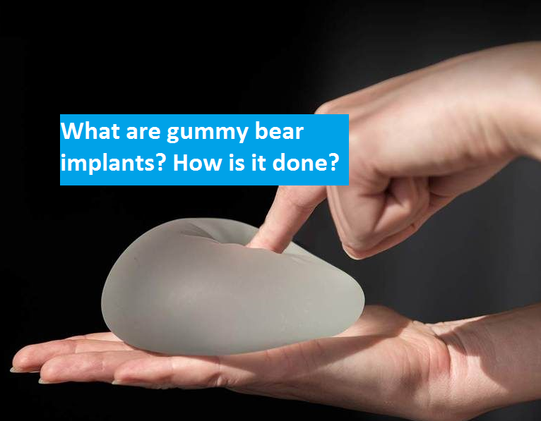 Livetv Watch What Are Gummy Bear Implants How Is It Done Live Stream Tv 